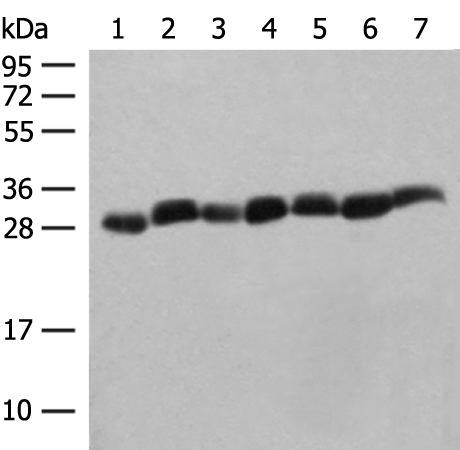 Rabbit Polyclonal Antibody to PSMA3