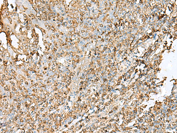 Rabbit Polyclonal Antibody to HLA-DPB1