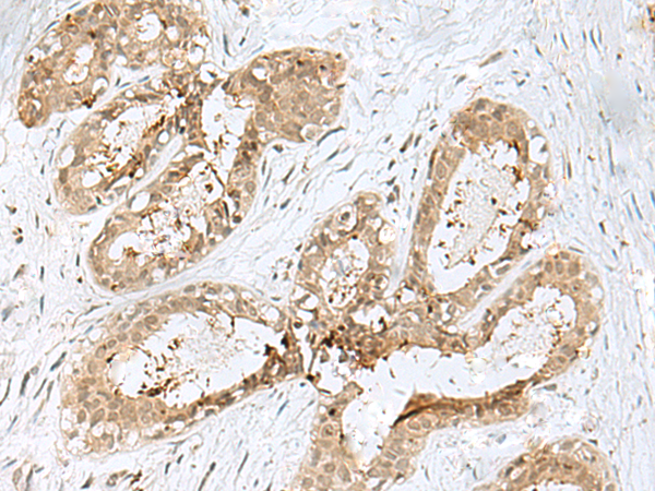 Rabbit Polyclonal Antibody to PSMA4