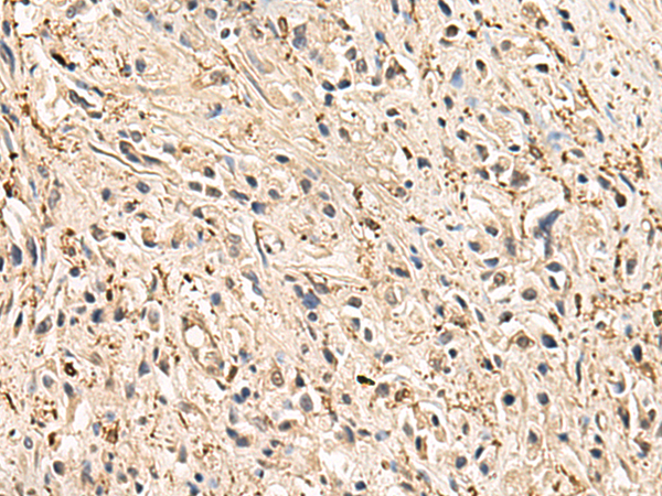 Rabbit Polyclonal Antibody to HLA-DQB1