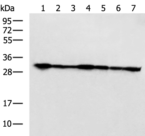 Rabbit Polyclonal Antibody to PSMA1