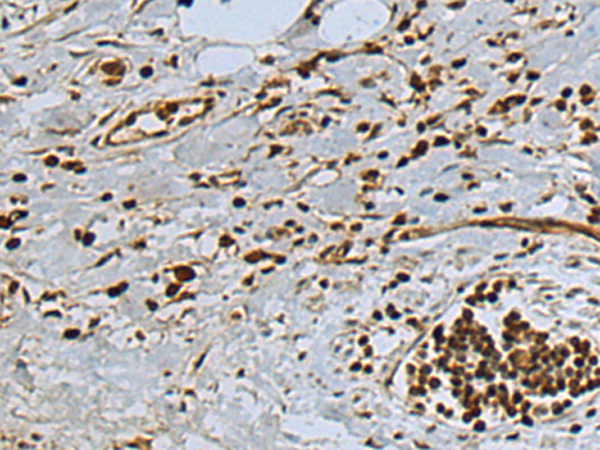Rabbit Polyclonal Antibody to PSMB10