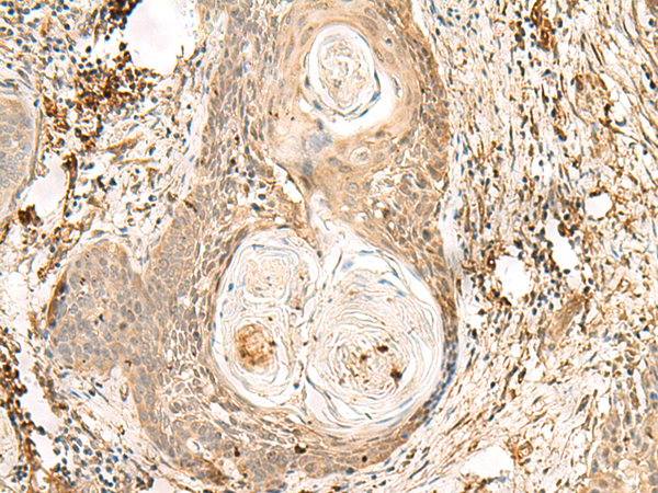 Rabbit Polyclonal Antibody to ZNF397