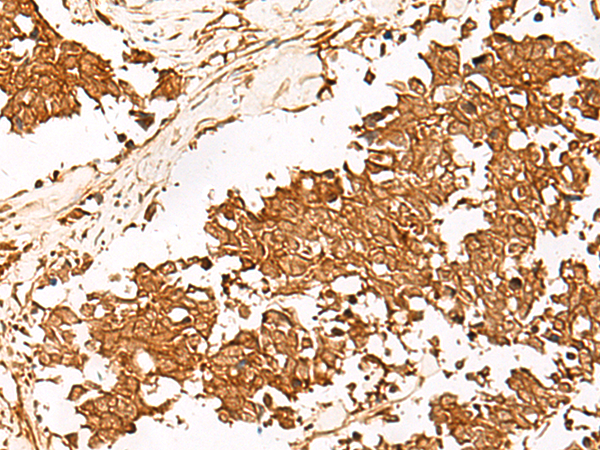 Rabbit Polyclonal Antibody to HUS1