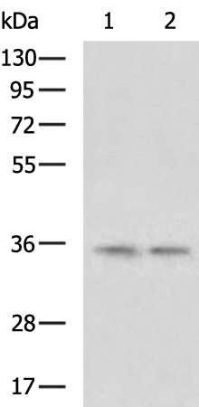 Rabbit Polyclonal Antibody to TXNL1