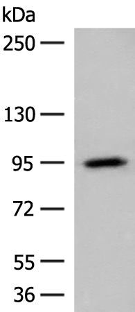 Rabbit Polyclonal Antibody to MELTF