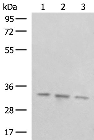 Rabbit Polyclonal Antibody to COPE