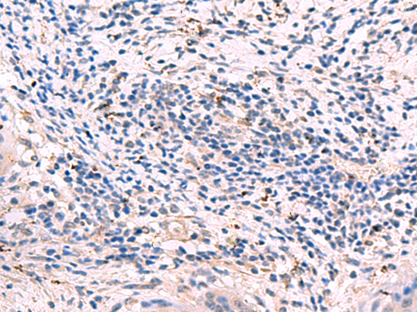 Rabbit Polyclonal Antibody to GKAP1