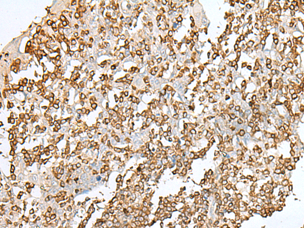 Rabbit Polyclonal Antibody to SEPTIN1