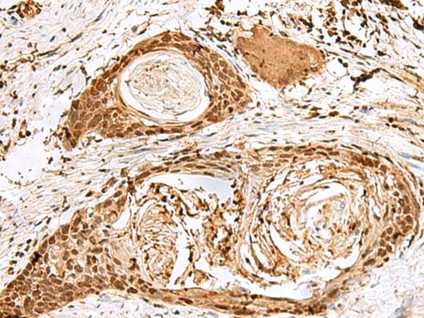 Rabbit Polyclonal Antibody to SNAPC1