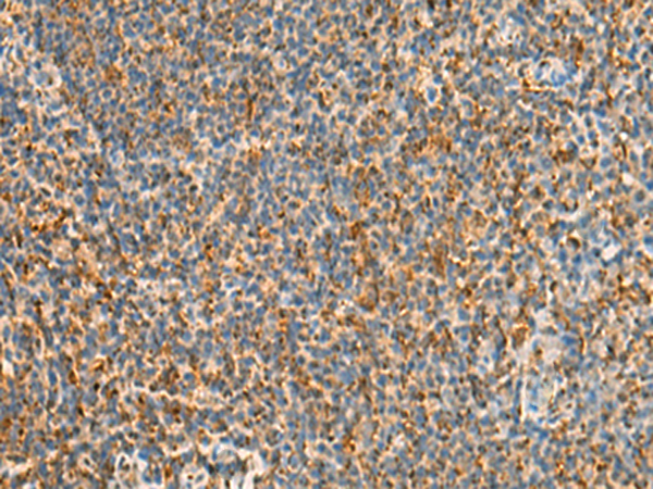 Rabbit Polyclonal Antibody to STK32C