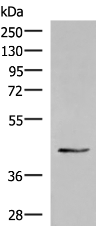 Rabbit Polyclonal Antibody to KRR1