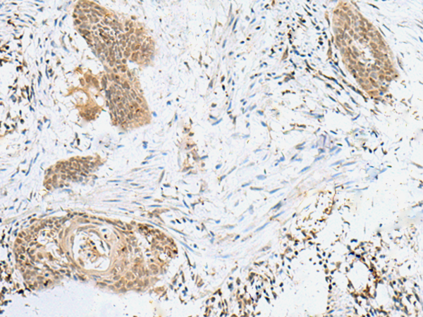 Rabbit Polyclonal Antibody to LPXN