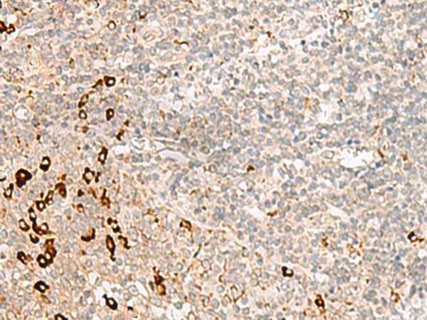 Rabbit Polyclonal Antibody to RMND5A