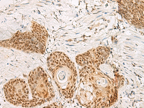 Rabbit Polyclonal Antibody to PSPC1