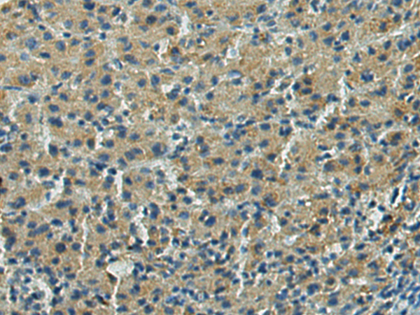 Rabbit Polyclonal Antibody to EIF2B3