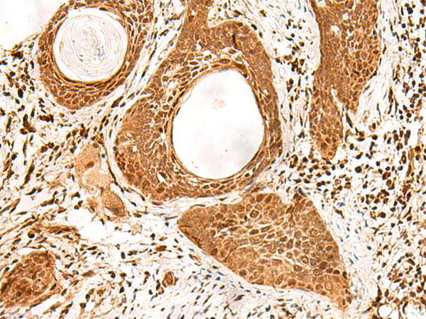 Rabbit Polyclonal Antibody to ADRM1