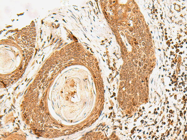 Rabbit Polyclonal Antibody to POLH