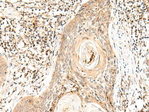 Rabbit Polyclonal Antibody to POLR1E