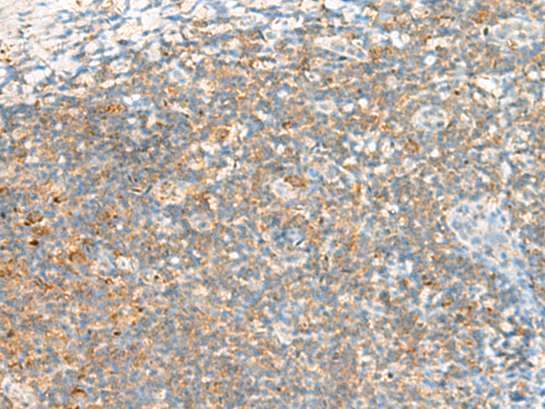 Rabbit Polyclonal Antibody to TTLL1