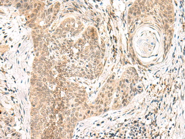 Rabbit Polyclonal Antibody to GPSM1