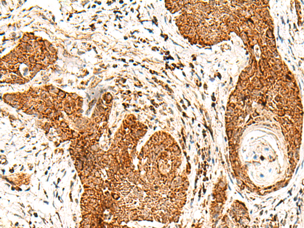Rabbit Polyclonal Antibody to SMOC1