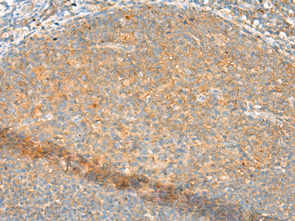 Rabbit Polyclonal Antibody to FNTB