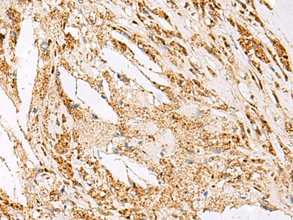 Rabbit Polyclonal Antibody to DNPEP