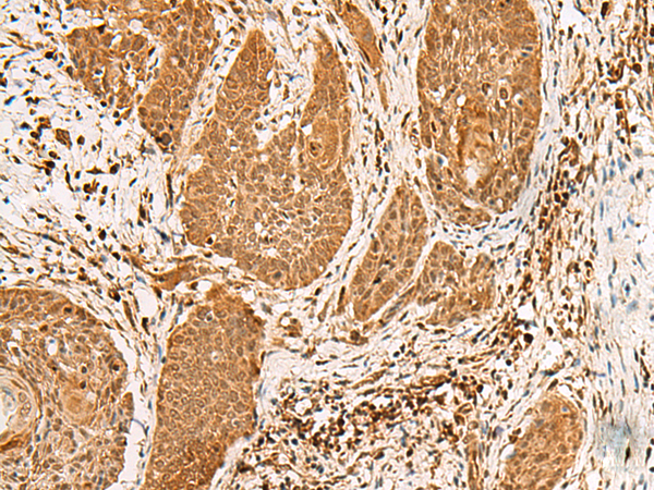 Rabbit Polyclonal Antibody to PPOX