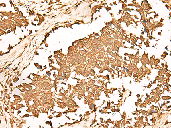 Rabbit Polyclonal Antibody to PWP1