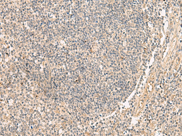 Rabbit Polyclonal Antibody to PAF1