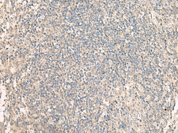 Rabbit Polyclonal Antibody to NRBP1