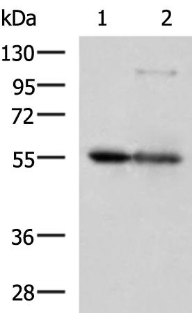 Rabbit Polyclonal Antibody to LPCAT2