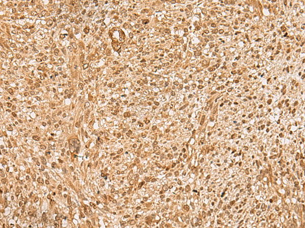Rabbit Polyclonal Antibody to HIRIP3