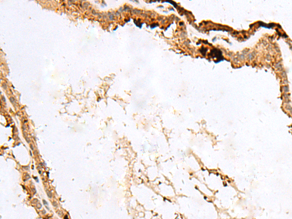 Rabbit Polyclonal Antibody to RABGGTA