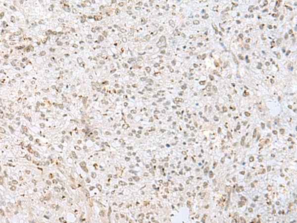 Rabbit Polyclonal Antibody to GTF3C2