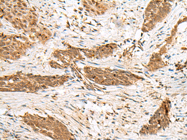 Rabbit Polyclonal Antibody to NUP58