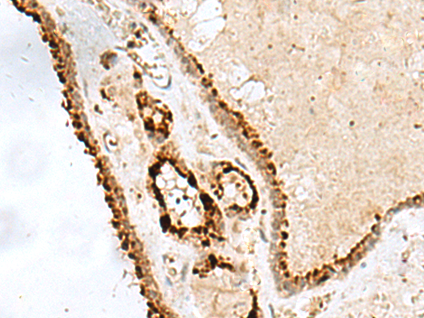 Rabbit Polyclonal Antibody to PHTF1