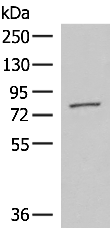 Rabbit Polyclonal Antibody to ECD