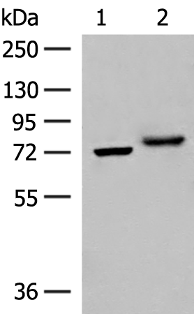 Rabbit Polyclonal Antibody to POMGNT1