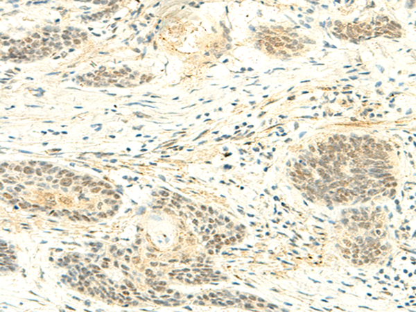 Rabbit Polyclonal Antibody to ATMIN