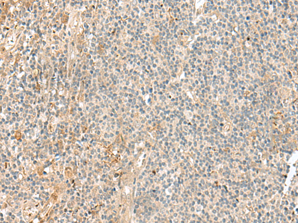Rabbit Polyclonal Antibody to NGEF