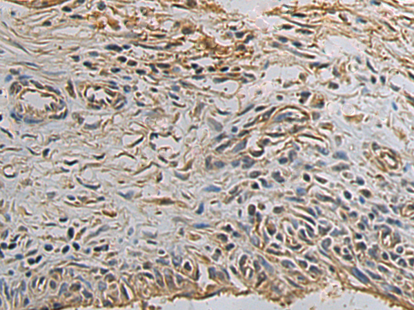 Rabbit Polyclonal Antibody to EXT1