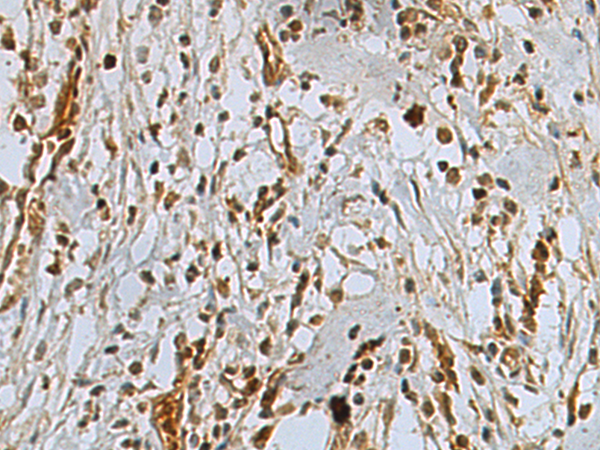 Rabbit Polyclonal Antibody to PAXIP1