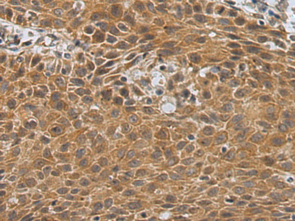 Rabbit Polyclonal Antibody to PLOD2