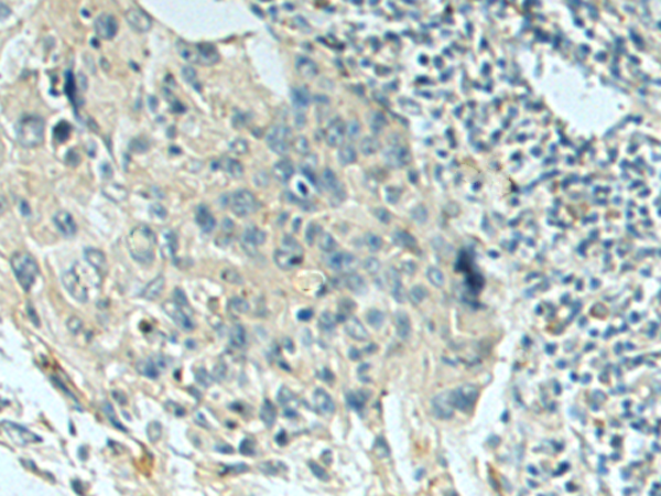 Rabbit Polyclonal Antibody to PIGQ
