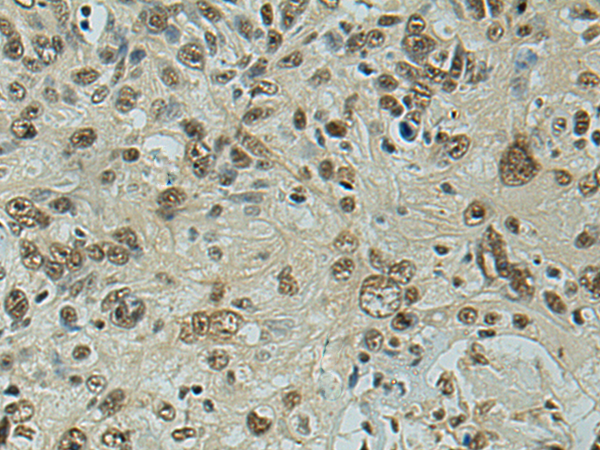 Rabbit Polyclonal Antibody to FSCB