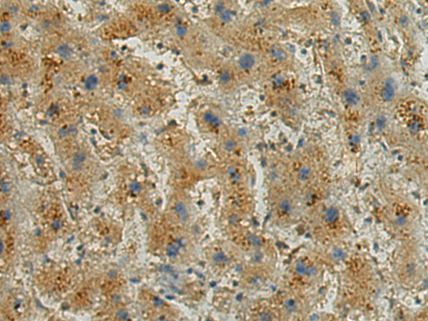 Rabbit Polyclonal Antibody to ATP6V0A1