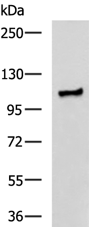 Rabbit Polyclonal Antibody to TTC16