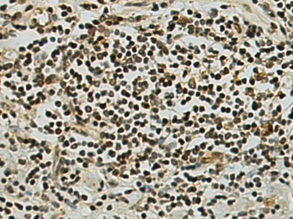 Rabbit Polyclonal Antibody to DIP2A